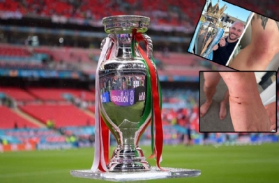 EURO 2028 adaylığımıza karşı İngiltere'den kara propaganda 