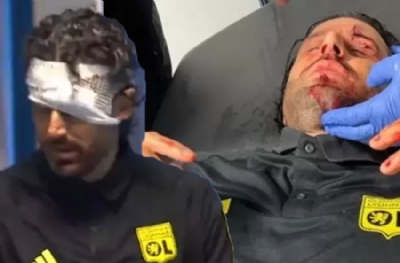 Marsilyalı vahşiler taş atıp Lyon'un hocasının kafasını yardı! Maç tatil edildi 