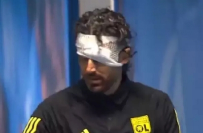 Fabio Grosso'nun durumu belli oldu! Vahşete 13 dikiş