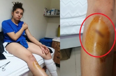 Bu teröre dur deme zamanı geldi! Kadın voleybolculara saldırmak da ne demek