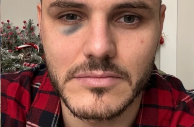 Icardi'ye hastaneden darp raporu alması, suç duyurusu yapması önerildi
