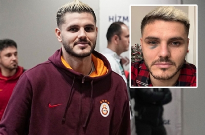 Icardi hastaneye götürüldü! Fenerbahçe derbisinde oynaması risk altında
