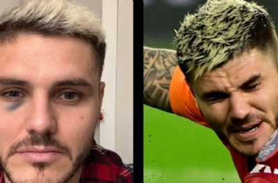 Icardi “Yumruğun” hesabını soracak